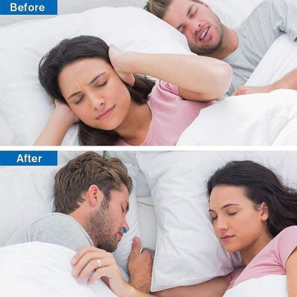 Anti_Snoring_Device_Gallery_Img4-min