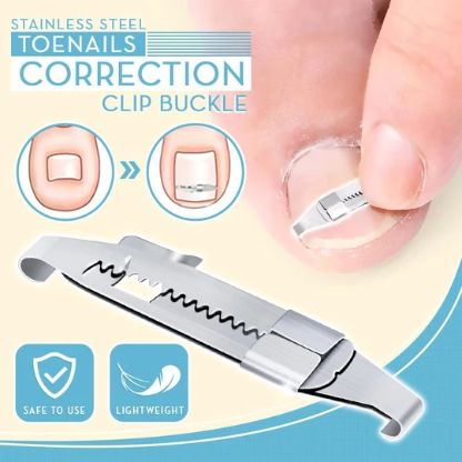 Toenails_Correction_Img1-min